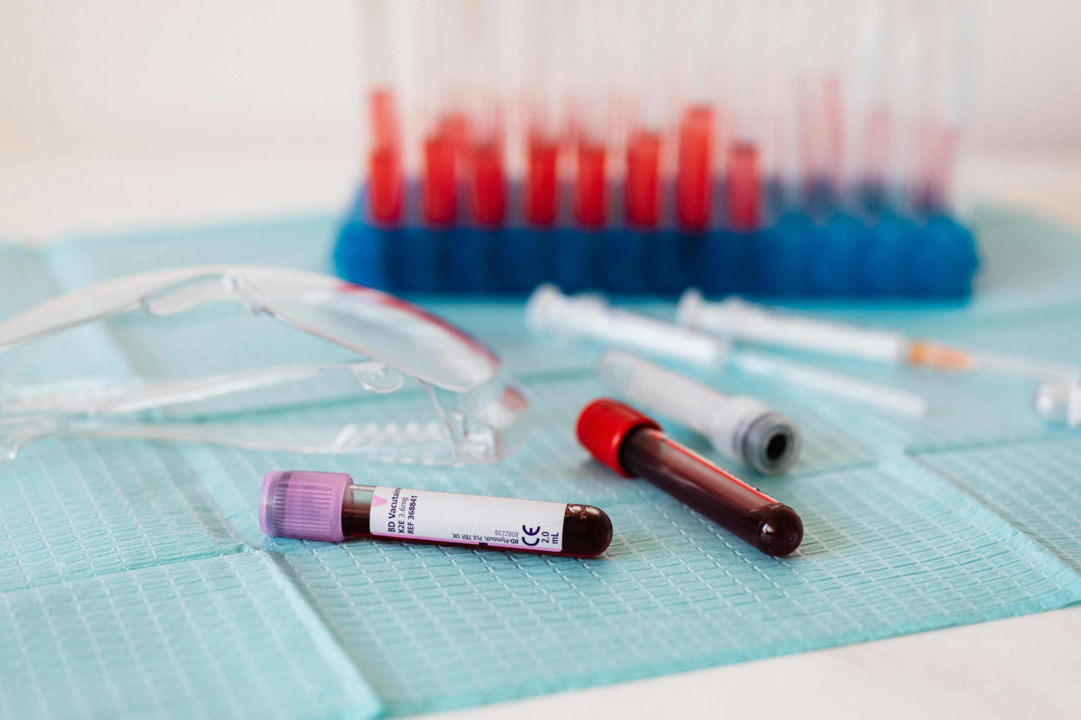 Home Sample Collection & Lab Tests